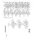 Fig. 09 - Mechanism for detecting coronary ischemia
