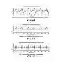 Fig. 04 - Electrical nerve stimulation with broad band low frequency filter