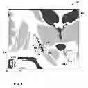 Fig. 10 - User interface with 3D environment for configuring stimulation therapy