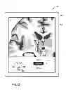 Fig. 24 - User interface with 3D environment for configuring stimulation therapy