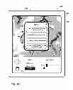 Fig. 32 - User interface with 3D environment for configuring stimulation therapy
