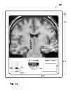 Fig. 37 - User interface with 3D environment for configuring stimulation therapy