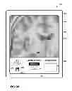 Fig. 40 - User interface with 3D environment for configuring stimulation therapy