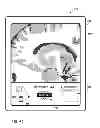 Fig. 46 - User interface with 3D environment for configuring stimulation therapy