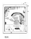 Fig. 55 - User interface with 3D environment for configuring stimulation therapy