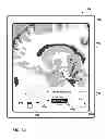 Fig. 60 - User interface with 3D environment for configuring stimulation therapy