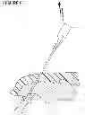 Fig. 07 - Neurostimulator Lead Extraction Tool