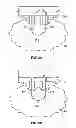 Fig. 06 - Methods and devices for treating tissue