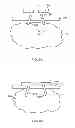 Fig. 09 - Methods and devices for treating tissue