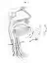 Fig. 04 - Electrical stimulation treatment of hypotension
