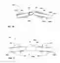Fig. 20 - Combination therapy including peripheral nerve field stimulation