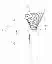 Fig. 04 - Retaining cage to permit resheathing of a tavi aortic-first transapical system