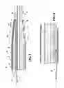 Fig. 04 - Integrated sheath and deployment