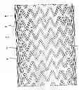 Fig. 01 - SELF-EXPANDING STENT