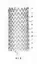 Fig. 07 - SELF-EXPANDING STENT