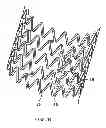 Fig. 15 - SELF-EXPANDING STENT