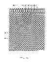 Fig. 16 - SELF-EXPANDING STENT