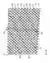 Fig. 17 - SELF-EXPANDING STENT