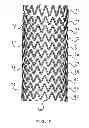 Fig. 18 - SELF-EXPANDING STENT