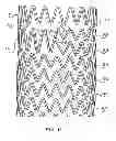 Fig. 19 - SELF-EXPANDING STENT
