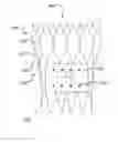 Fig. 01 - Sizing device and method of positioning a prosthetic heart valve