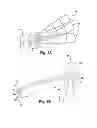 Fig. 02 - Pre-sized prosthetic chordae implantation system