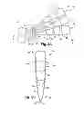Fig. 03 - Pre-sized prosthetic chordae implantation system