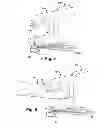 Fig. 09 - Pre-sized prosthetic chordae implantation system