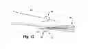 Fig. 11 - Pre-sized prosthetic chordae implantation system