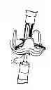 Fig. 01 - Delivery systems and methods of implantation for replacement prosthetic heart valve