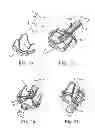 Fig. 07 - Delivery systems and methods of implantation for replacement prosthetic heart valve