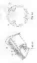 Fig. 09 - Delivery systems and methods of implantation for replacement prosthetic heart valve