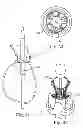 Fig. 10 - Delivery systems and methods of implantation for replacement prosthetic heart valve