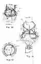 Fig. 11 - Delivery systems and methods of implantation for replacement prosthetic heart valve