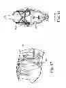 Fig. 12 - Delivery systems and methods of implantation for replacement prosthetic heart valve