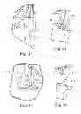 Fig. 14 - Delivery systems and methods of implantation for replacement prosthetic heart valve