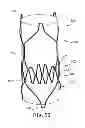 Fig. 20 - Delivery systems and methods of implantation for replacement prosthetic heart valve