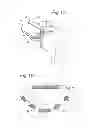 Fig. 07 - ASSEMBLY COMPRISING A STABILISER AND AN INSTRUMENT TO BE POSITIONED IN OR AROUND A PASSAGE SURROUNDED BY BODY TISSUE