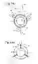 Fig. 08 - ASSEMBLY COMPRISING A STABILISER AND AN INSTRUMENT TO BE POSITIONED IN OR AROUND A PASSAGE SURROUNDED BY BODY TISSUE