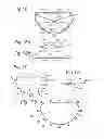 Fig. 09 - ASSEMBLY COMPRISING A STABILISER AND AN INSTRUMENT TO BE POSITIONED IN OR AROUND A PASSAGE SURROUNDED BY BODY TISSUE
