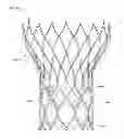 Fig. 01 - ROUGHENED CUFF SURFACE