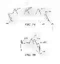 Fig. 03 - ROUGHENED CUFF SURFACE