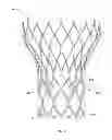 Fig. 05 - ROUGHENED CUFF SURFACE