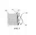 Fig. 06 - ROUGHENED CUFF SURFACE
