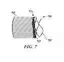 Fig. 08 - ROUGHENED CUFF SURFACE