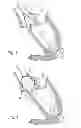Fig. 07 - METHODS AND DEVICES FOR REPAIR OR REPLACEMENT OF HEART VALVES OR ADJACENT TISSUE WITHOUT THE NEED FOR FULL CARDIOPULMONARY SUPPORT