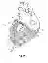 Fig. 02 - Cardiac treatment system