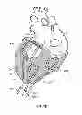 Fig. 03 - Cardiac treatment system