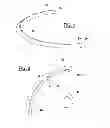 Fig. 02 - Intrastomal segment