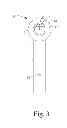 Fig. 04 - Voice Prosthesis